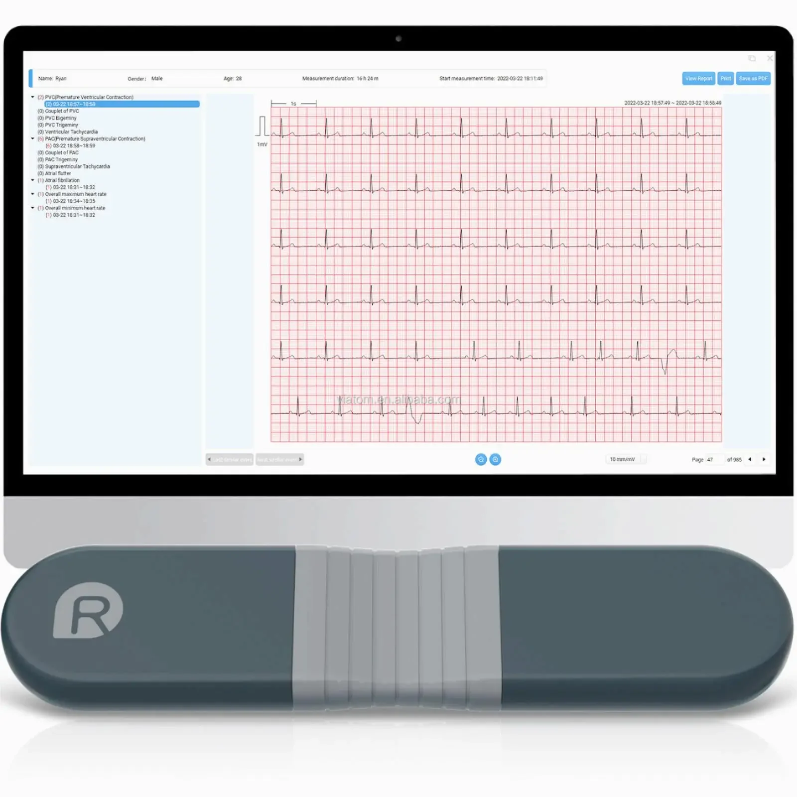 Wireless Bluetooth Dynamic Rec - đánh giá và giá Ecg Patch Monitor